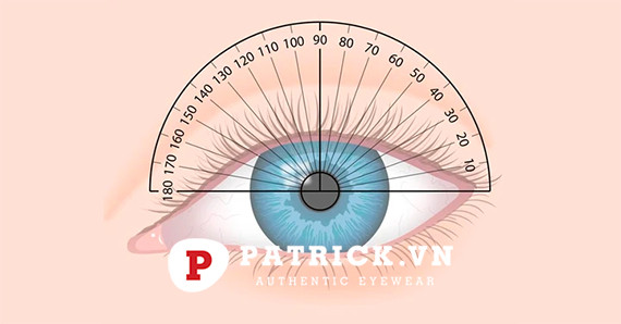 Loạn thị là gì