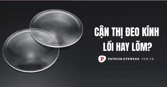 Bị cận thị đeo kính gì, lồi hay lõm?