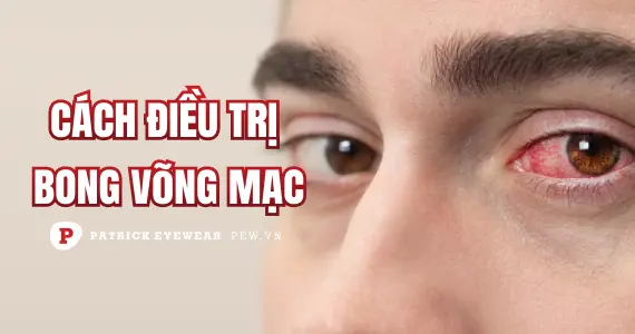 Bong võng mạc: Nguyên nhân và cách điều trị