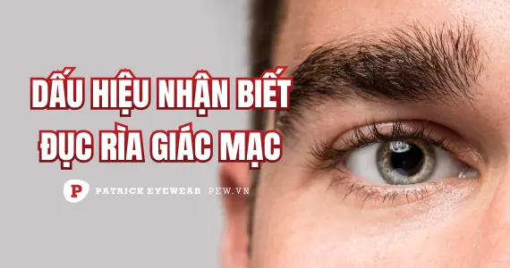 Đục rìa giác mạc là bệnh gì?