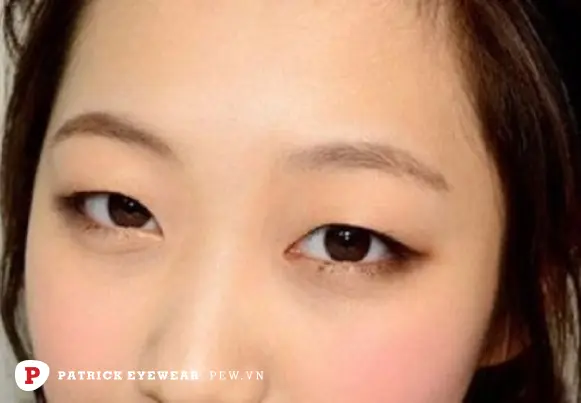 Mắt híp là mắt như thế nào, đẹp hay xấu