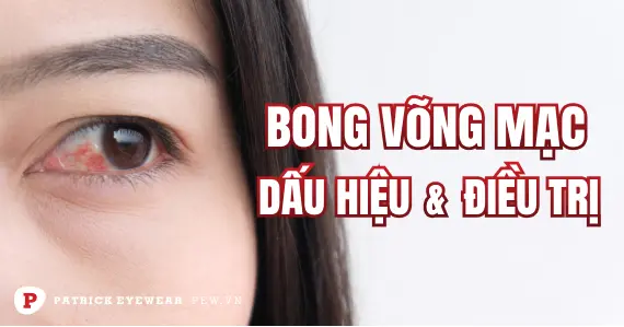Bong võng mạc: Nguyên nhân và cách điều trị