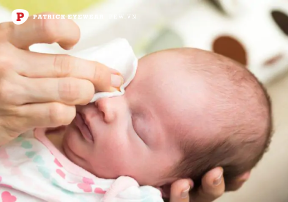 Mắt trẻ sơ sinh bị ghèn vàng có đáng lo ngại không
