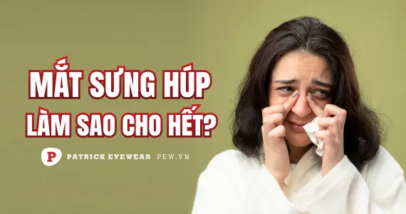 Mắt bị sưng húp phải làm sao?