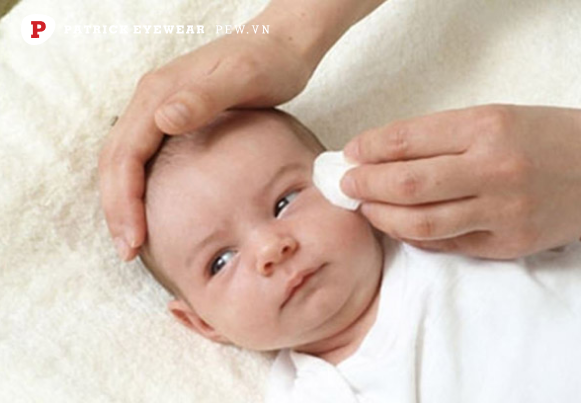 Cách vệ sinh mắt trẻ sơ sinh: Những điều mẹ cần biết