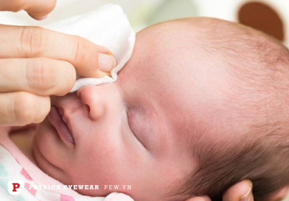 Cách vệ sinh mắt trẻ sơ sinh: Những điều mẹ cần biết