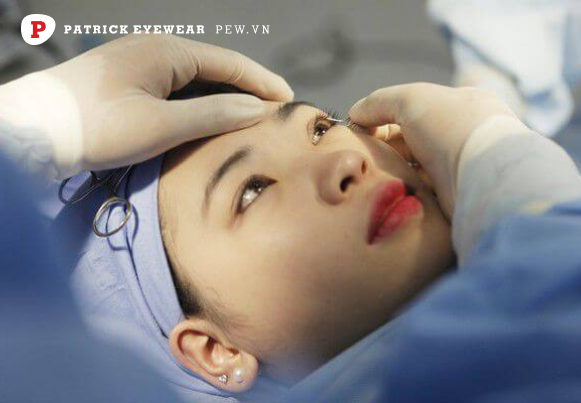 Cận 20 độ có nguy hiểm không, có mổ được không