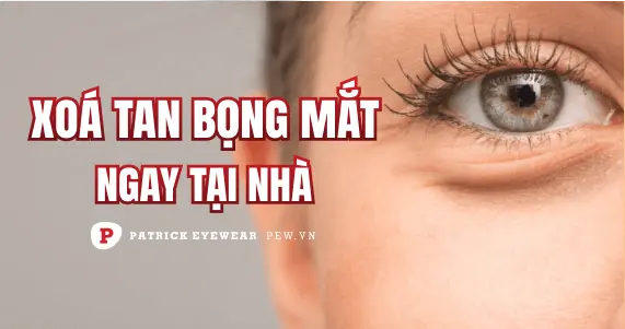 Cách chữa bọng mắt dưới ngay tại nhà