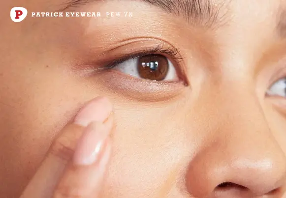 bọng mắt là gì Cách chữa bọng mắt dưới ngay tại nhà