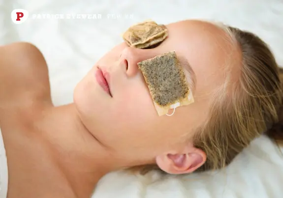 Cách chữa bọng mắt dưới ngay tại nhà Cách chữa bọng mắt dưới ngay tại nhà