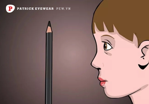 mắt lồi cận thị phải làm sao Mắt lồi: Nguyên nhân, triệu chứng và cách điều trị