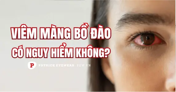 Viêm màng bồ đào có nguy hiểm không, bao lâu khỏi?