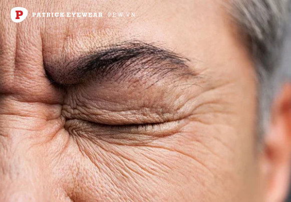 ngứa mắt trái cảnh báo bệnh lý về mắt Ngứa mắt trái là điềm gì, ngứa theo giờ có nguy hiểm không