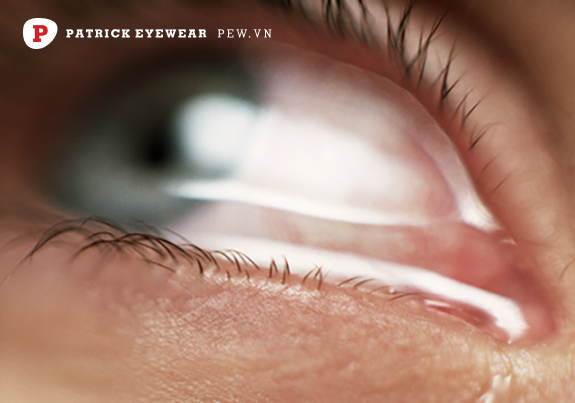 Ngứa mắt trái cảnh báo bệnh lý về mắt Ngứa mắt trái là điềm gì, ngứa theo giờ có nguy hiểm không