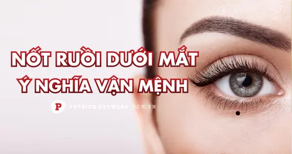 Nốt ruồi dưới mắt: Vị trí tốt, xấu và vận mệnh