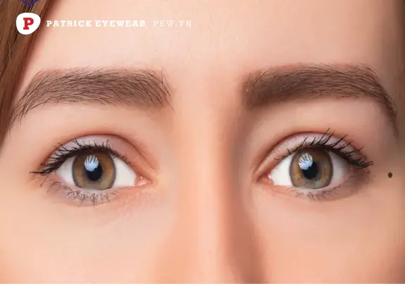 Vị trí tốt, xấu và vận mệnh nốt ruồi dưới mắt