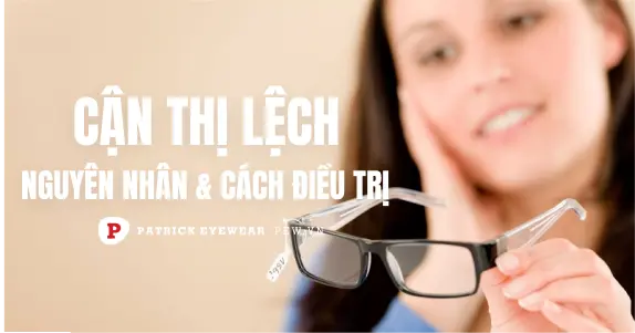 Cận thị lệch: Nguyên nhân và cách điều trị