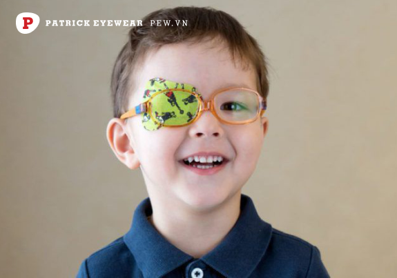 cận thị lệch có nguy hiểm không Cận thị lệch: Nguyên nhân và cách điều trị