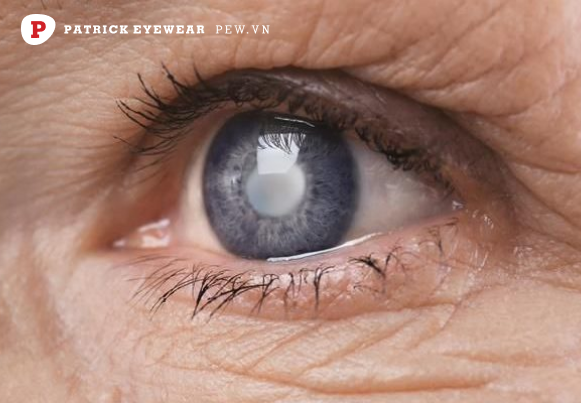 tác hại của việc mổ mắt Mổ mắt cận thị: 10 tác hại và biến chứng nguy hiểm sau phẫu thuật