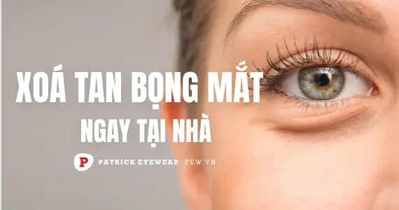 Cách chữa bọng mắt dưới ngay tại nhà