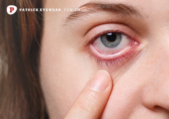 Tác hại của Ortho-K và biến chứng nguy hiểm cho đôi mắt